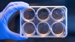 Das Foto vom 15.02.08 zeigt Differenzierungsversuche mit humanen embryonalen Stammzellen am Institut für Neurophysiologie der Universität Köln.